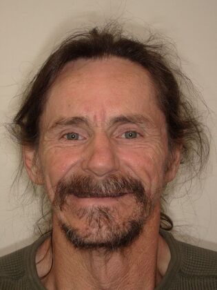 NuSmile Transformations David - Before