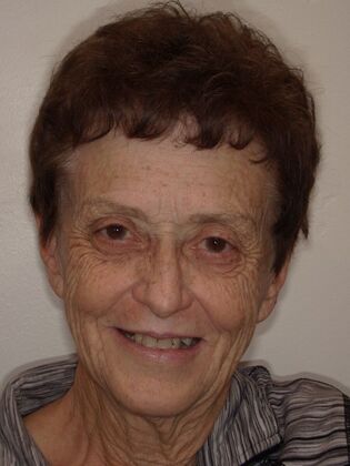 NuSmile Transformations Kathy  - Before