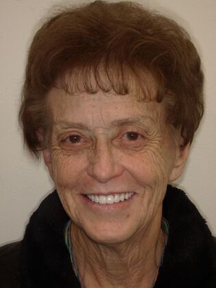 NuSmile Transformations Kathy  - After