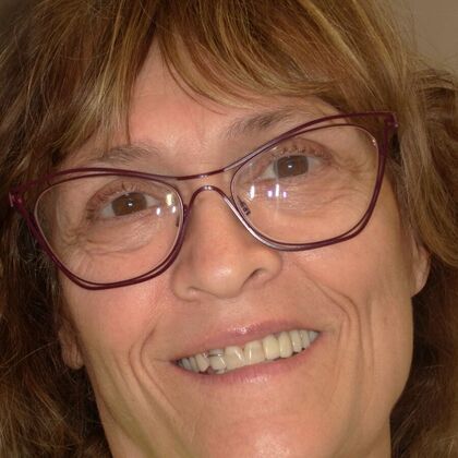 NuSmile Transformations Holly - Before