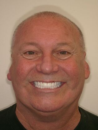 NuSmile Transformations Scott  - After