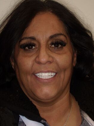 NuSmile Transformations Kristy  - After