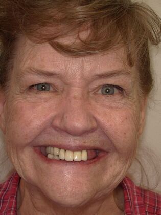 NuSmile Transformations DeRae - Before