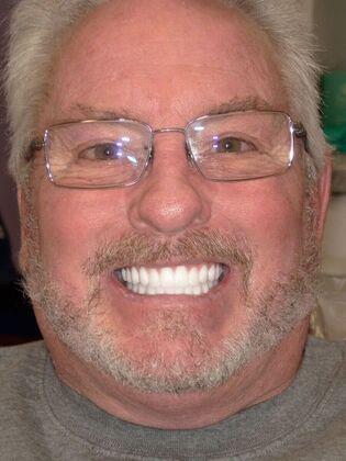 NuSmile Transformations Jim  - After