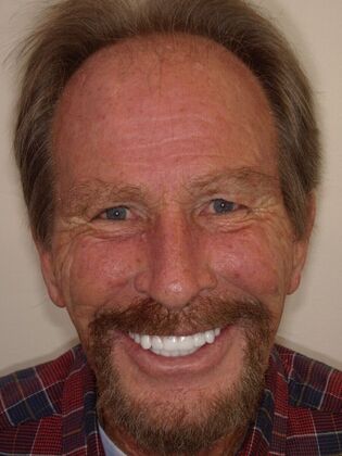 NuSmile Transformations Roy - After