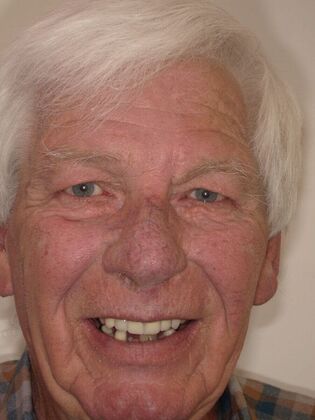 NuSmile Transformations Bob - Before