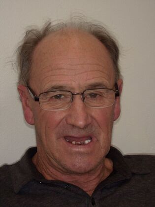 NuSmile Transformations Kimball - Before