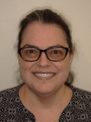 NuSmile Transformations Rhonda - After