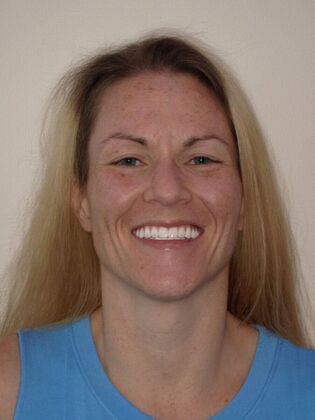 NuSmile Transformations Sarah  - After