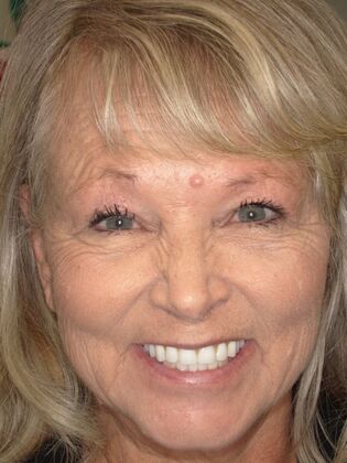 NuSmile Transformations Marcy 