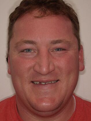 NuSmile Transformations Sheldon - Before