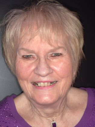 NuSmile Transformations Marie  - Before