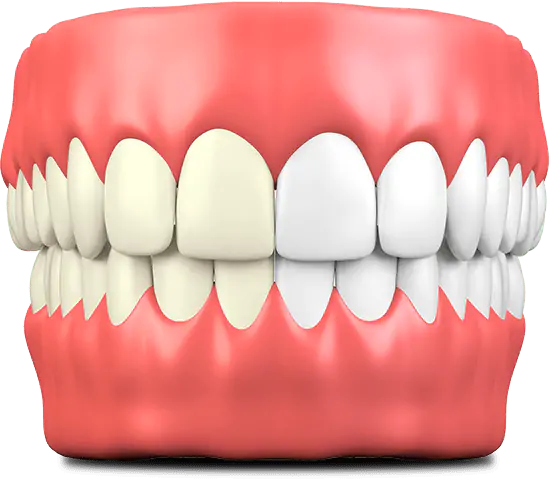 graphic showing teeth discoloration